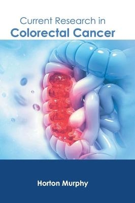 Current Research in Colorectal Cancer - 