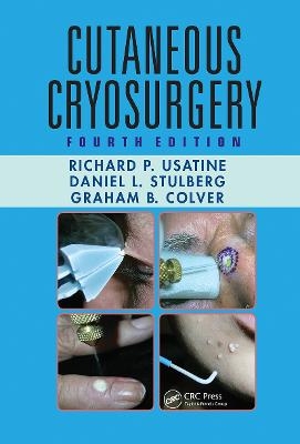 Cutaneous Cryosurgery - Richard P. Usatine, Daniel L. Stulberg, Graham B. Colver