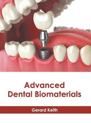 Advanced Dental Biomaterials - 