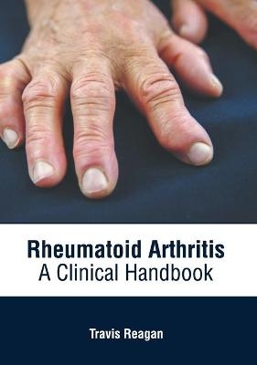 Rheumatoid Arthritis: A Clinical Handbook - 