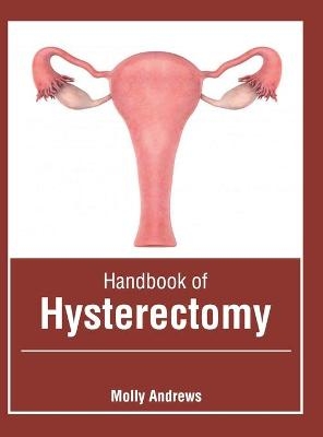 Handbook of Hysterectomy - 