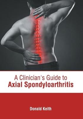 A Clinician's Guide to Axial Spondyloarthritis - 