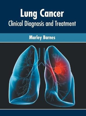 Lung Cancer: Clinical Diagnosis and Treatment - 