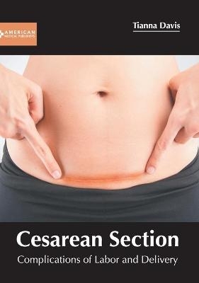 Cesarean Section: Complications of Labor and Delivery - 