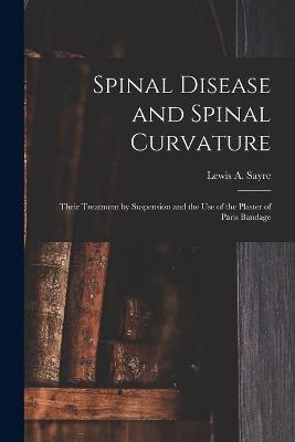 Spinal Disease and Spinal Curvature - 