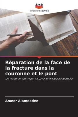 Réparation de la face de la fracture dans la couronne et le pont - Ameer Alameedee