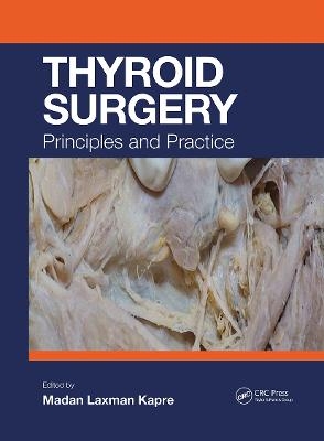 Thyroid Surgery - 