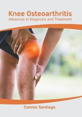 Knee Osteoarthritis: Advances in Diagnosis and Treatment - 