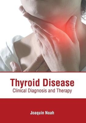 Thyroid Disease: Clinical Diagnosis and Therapy - 