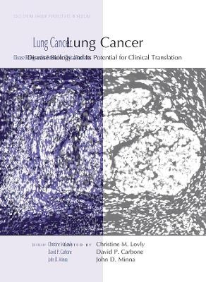 Lung Cancer - 