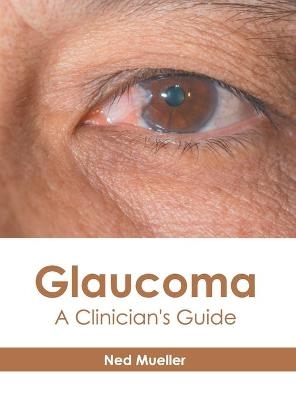 Glaucoma: A Clinician's Guide - 