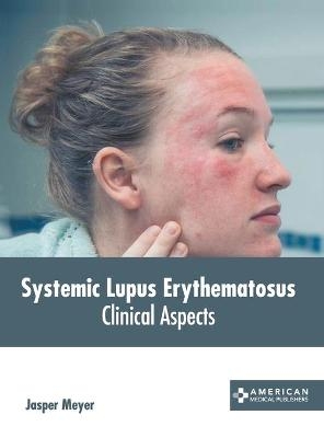 Systemic Lupus Erythematosus: Clinical Aspects - 