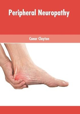 Peripheral Neuropathy - 