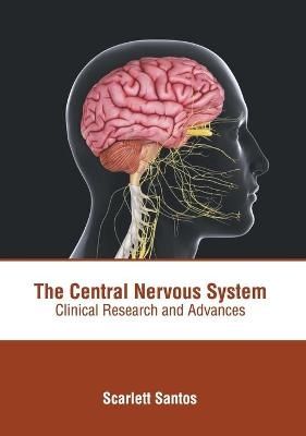 The Central Nervous System: Clinical Research and Advances - 