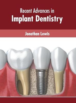 Recent Advances in Implant Dentistry - 