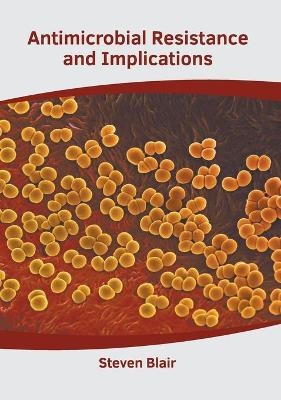 Antimicrobial Resistance and Implications - 