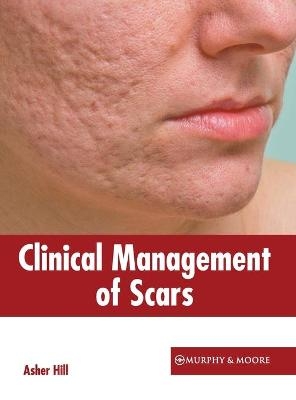 Clinical Management of Scars - 