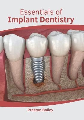 Essentials of Implant Dentistry - 