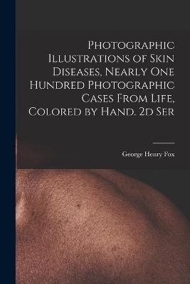 Photographic Illustrations of Skin Diseases, Nearly One Hundred Photographic Cases From Life, Colored by Hand. 2d Ser - George Henry 1846-1937 Fox