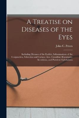 A Treatise on Diseases of the Eyes; Including Diseases of the Eyelids, Inflammations of the Conjunctiva, Sclerotica and Cornea; Also, Catarrhal, Rheumatic, Scrofulous, and Purulent Ophthalmia - 