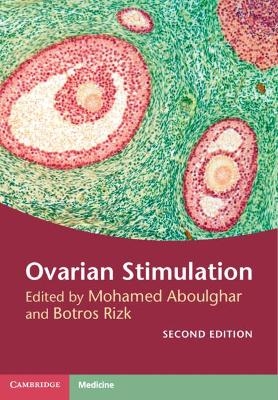 Ovarian Stimulation - 