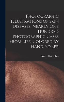 Photographic Illustrations of Skin Diseases, Nearly One Hundred Photographic Cases From Life, Colored by Hand. 2d Ser - George Henry 1846-1937 Fox