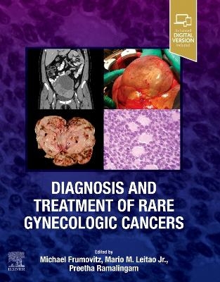 Diagnosis and Treatment of Rare Gynecologic Cancers - Michael Frumovitz, Mario M. Leitao Jr., Preetha Ramalingam