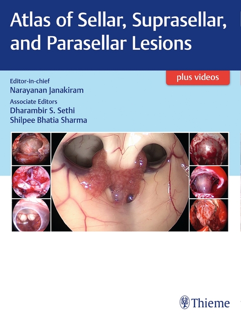 Atlas of Sellar, Suprasellar, and Parasellar Lesions - 