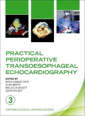 Practical Perioperative Transoesophageal Echocardiography - 