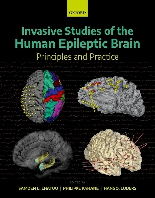 Invasive Studies of the Human Epileptic Brain - 