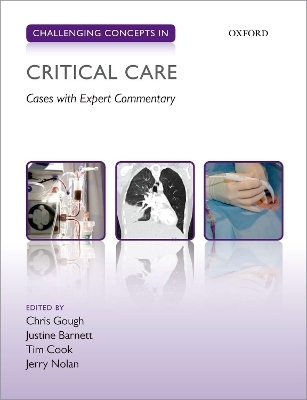 Challenging Concepts in Critical Care - 