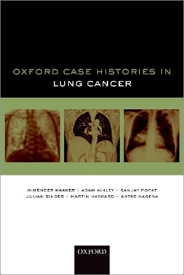 Oxford Case Histories in Lung Cancer - Himender K. Makker, Adam Ainley, Sanjay Popat, Julian Singer, Martin Hayward