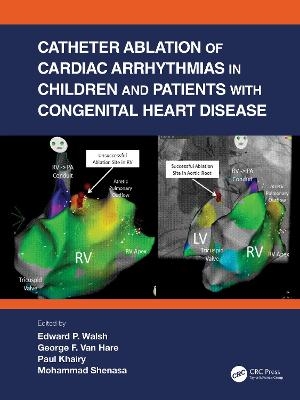 Catheter Ablation of Cardiac Arrhythmias in Children and Patients with Congenital Heart Disease - 