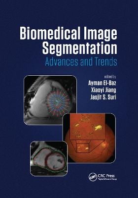 Biomedical Image Segmentation - 