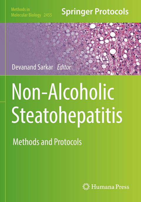 Non-Alcoholic Steatohepatitis - 