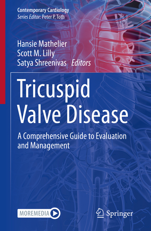 Tricuspid Valve Disease - 