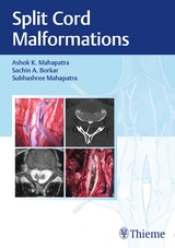 Split Cord Malformations - Ashok Mahapatra, Sachin Borkar, Subhashree Mahapatra