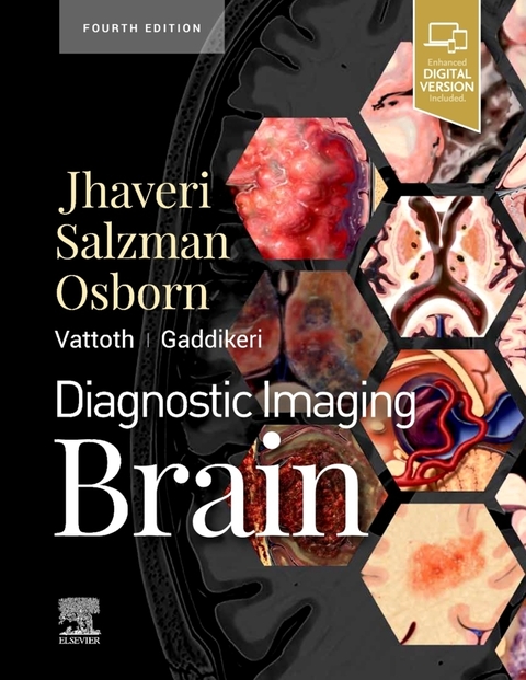 Diagnostic Imaging: Brain - Miral D Jhaveri