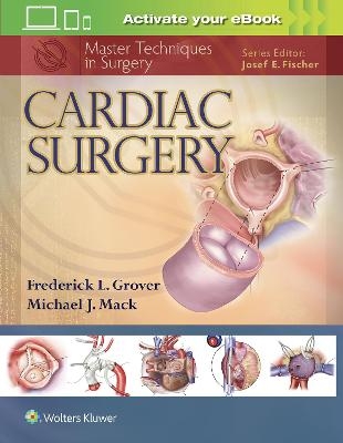 Cardiac Surgery - Frederick Grover, Dr. Michael J. Mack