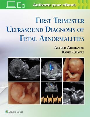 First Trimester Ultrasound Diagnosis of Fetal Abnormalities - Alfred Z. Abuhamad, Rabih Chaoui