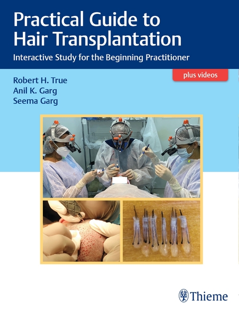 Practical Guide to Hair Transplantation - Robert True, Anil Garg, Seema Garg