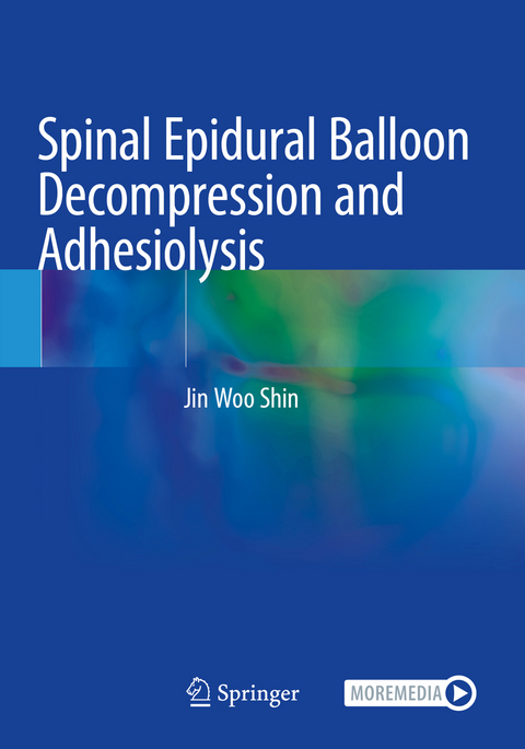 Spinal Epidural Balloon Decompression and Adhesiolysis - Jin Woo Shin