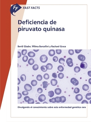 Fast Facts: Deficiencia de piruvato quinasa - Bertil Glader, Wilma Barcellini, Rachael Grace
