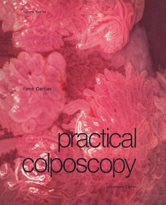 Practical Colposcopy - R. Cartier