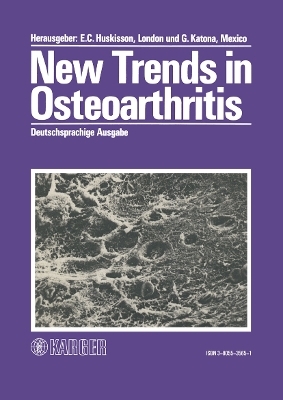 New Trends in Osteoarthritis - 