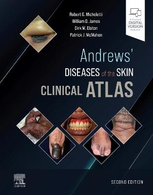 Andrews' Diseases of the Skin Clinical Atlas - Robert G. Micheletti, William D. James, Dirk M. Elston, Patrick J. McMahon