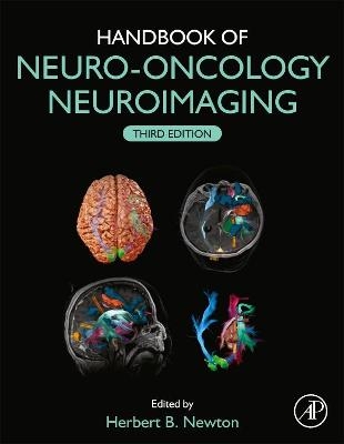 Handbook of Neuro-Oncology Neuroimaging - 