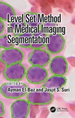 Level Set Method in Medical Imaging Segmentation - 