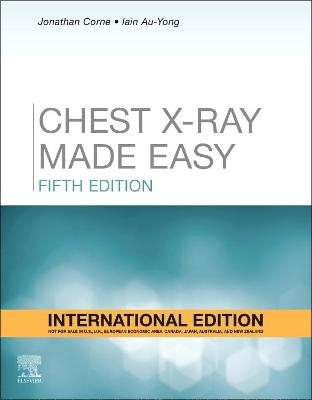 Chest X-Ray Made Easy, International Edition - Jonathan Corne, Iain Au-Yong