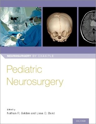 Pediatric Neurosurgery - 